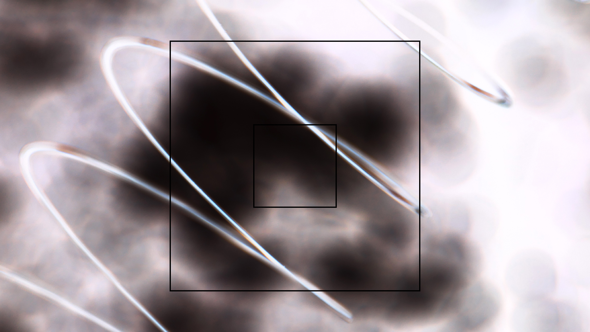 2022-08-27 Das Kleine Regen Rhythmus Orchester (Alublech, Federhall Errorcut) (Audio, Foto)