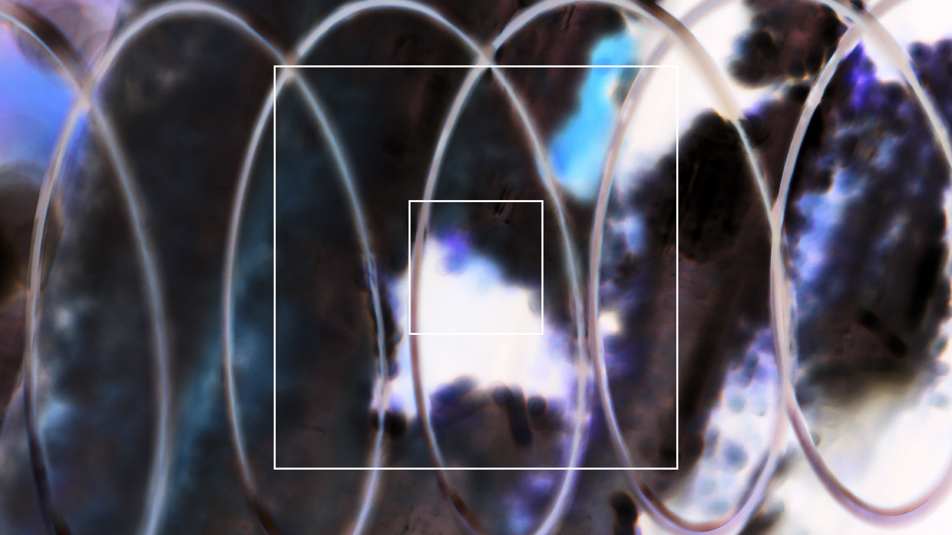 2022-08-27 Das Kleine Regen Rhythmus Orchester (Alublech, Federhall Errorcut) (Audio, Foto)