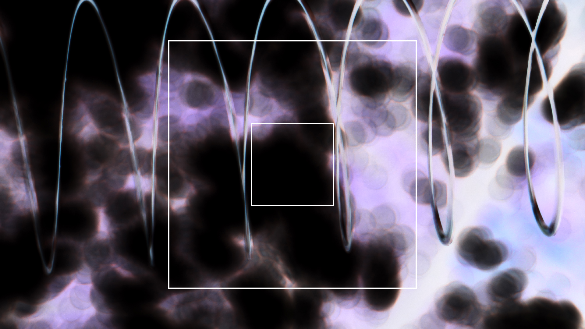 2022-08-27 Das Kleine Regen Rhythmus Orchester (Alublech, Federhall Errorcut) (Audio, Foto)