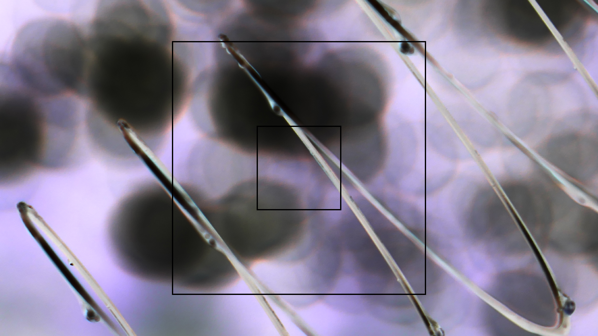 2022-08-27 Das Kleine Regen Rhythmus Orchester (Alublech, Federhall Errorcut) (Audio, Foto)