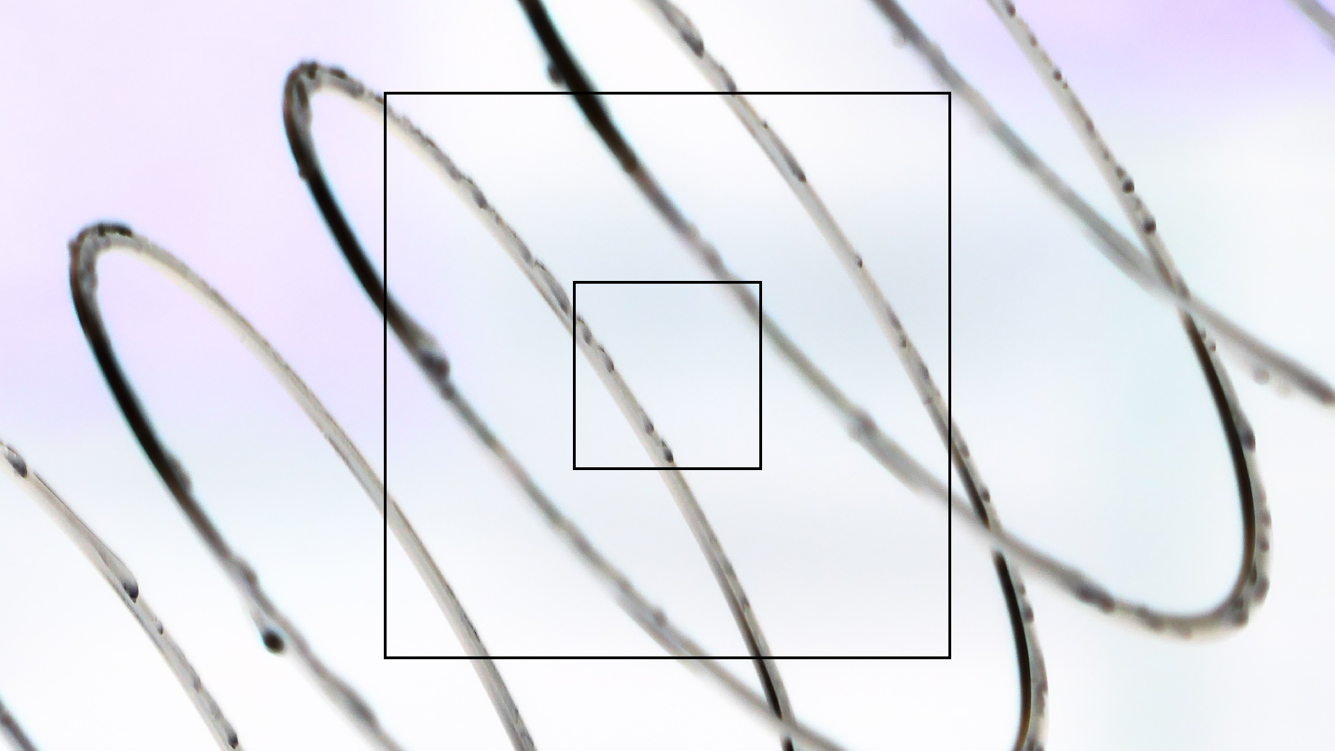 2022-08-27 Das Kleine Regen Rhythmus Orchester (Alublech, Federhall Errorcut) (Audio, Foto)