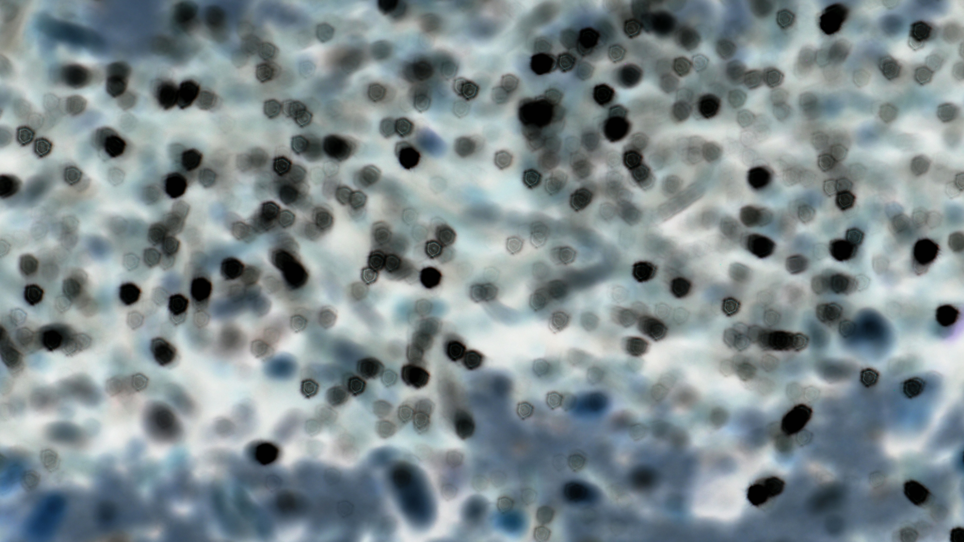 2021-09-17 03 Parasporos Beach Club (Zikaden) (Fieldrecording, Foto, Video)