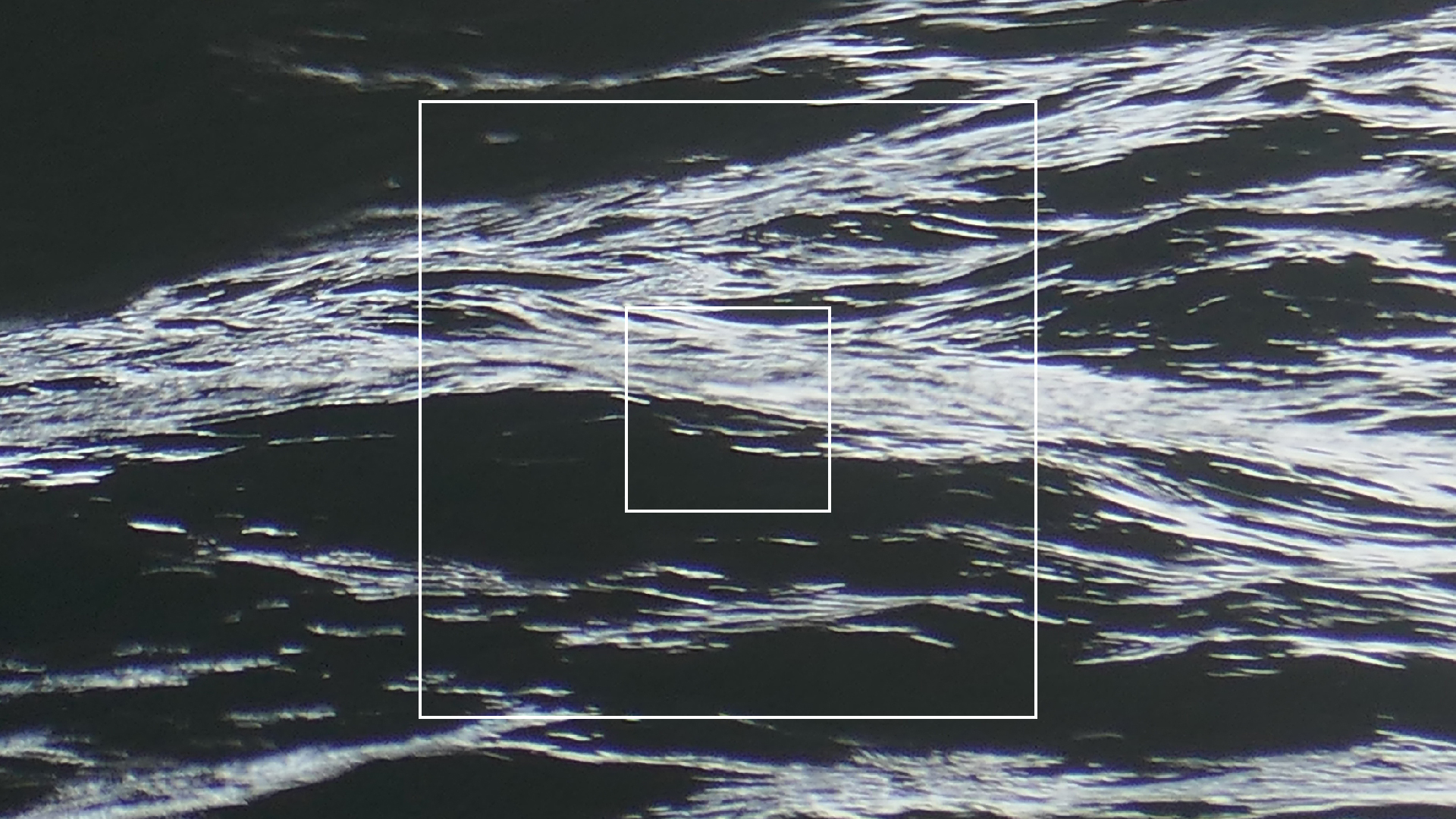 2022-04-23 Shete Boka Nationalpark (Foto, Video)